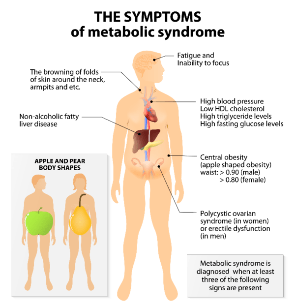 Metabolic Syndrome Symptoms:  The combination of several symptoms combined are part of metabolic syndrome.  