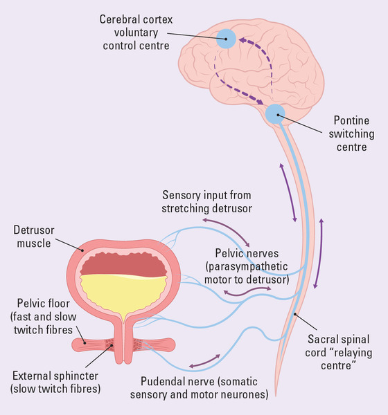 Diabetic Cystopathy is a urological complications  caused by hyperglycemia.