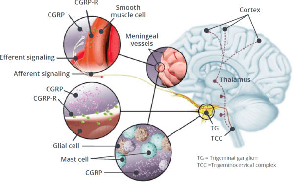 Comprehensive migraine treatment can include lifestyle changes