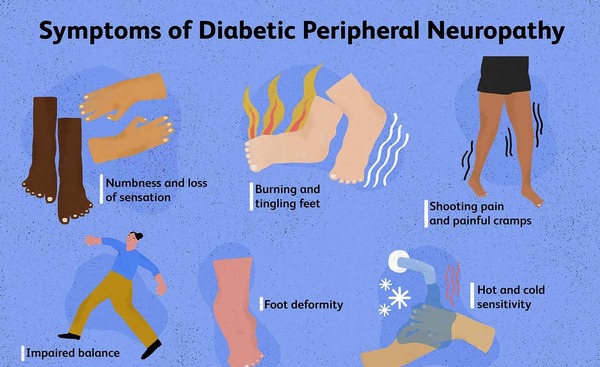 In diabetic cystopathy, micturition, the process of urinating is adversely impacted.  