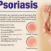 Chronic skin conditions include plaque psoriasis